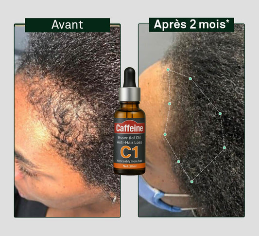 Huile à la Cafféine C1 contre la chute de cheveux