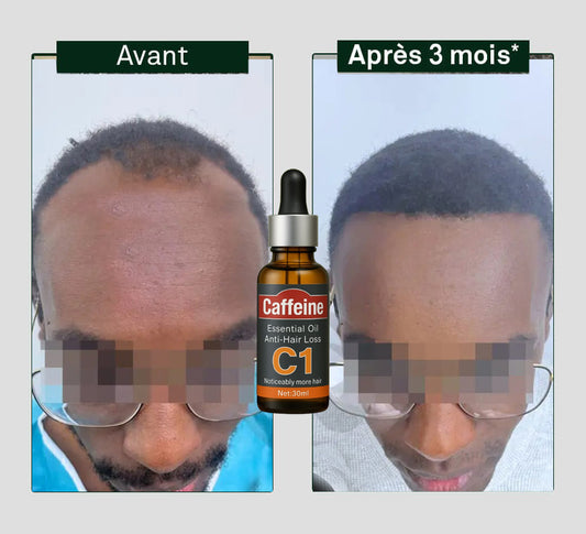 Huile à la Cafféine C1 contre la chute de cheveux
