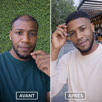 Huile à la caffeine C1 contre la chute de cheveux