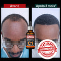 Huile à la caffeine C1 contre la chute de cheveux