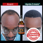 Huile à la caffeine C1 contre la chute de cheveux