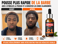 Huile - Pousse barbe