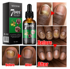 Huile réparatrice d'ongles