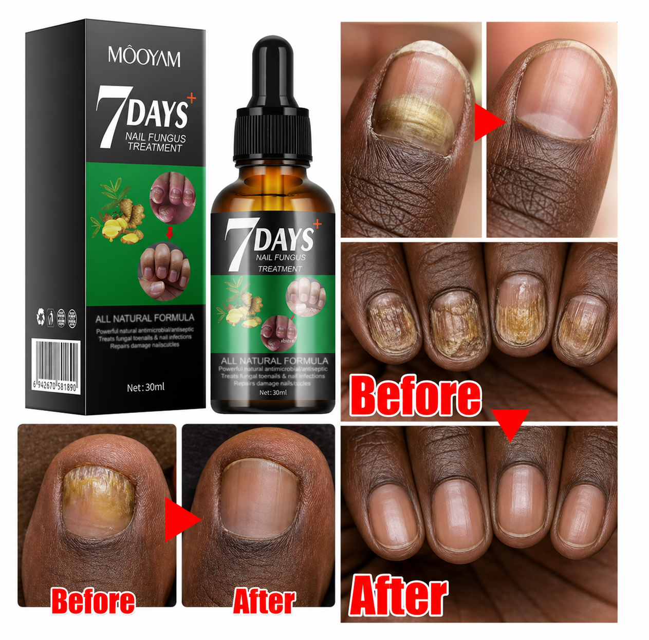 Huile réparatrice d'ongles
